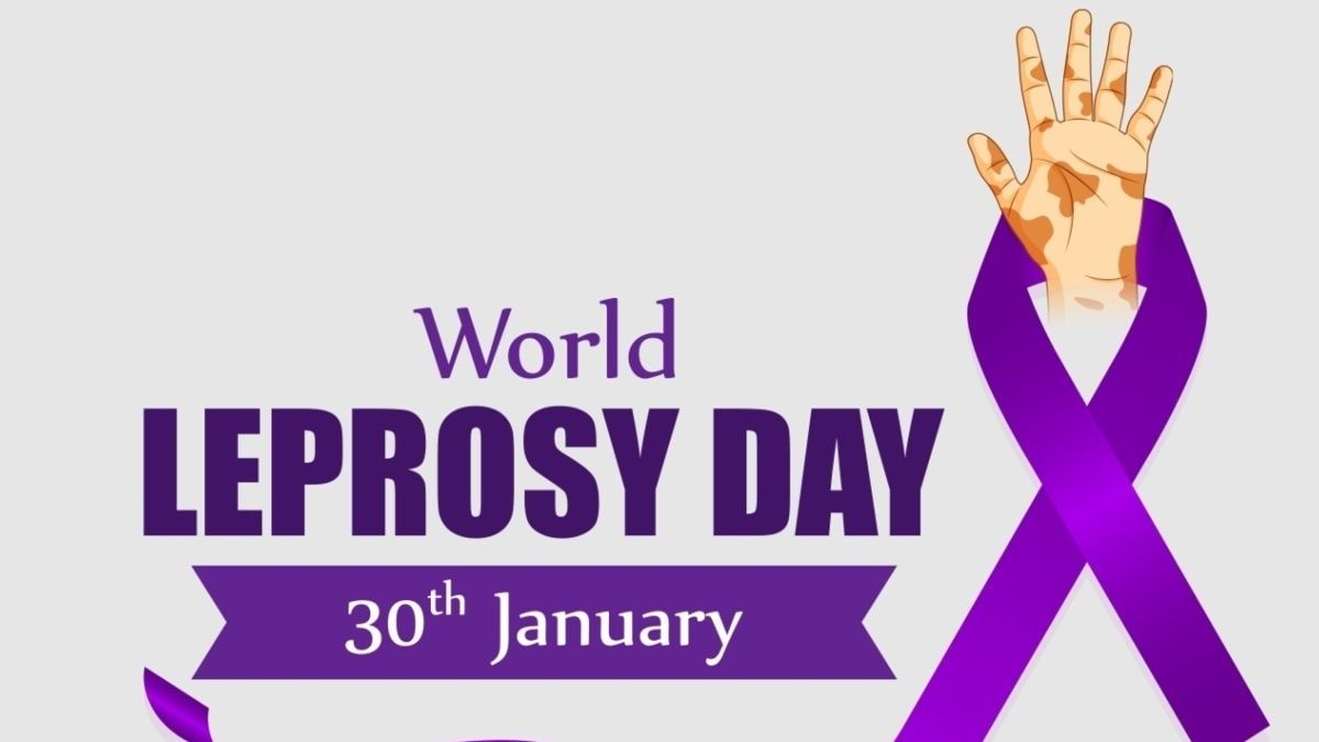 leprosy-day-2024-january-30-2024-01-8416249c90aa5720b179b5e1fe4e58d0-16x9.jpg