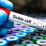 107377453-1708696168205-gettyimages-1824452072-sicklecell.jpeg