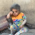 AA-20240717-35164347-35164342-PALESTINIAN_GIRL_PHOTOGRAPHED_SHORTLY_AFTER_ISRAELI_ATTACK_ENDURES_BRUTAL_CONDITIONS_IN_GAZA-1721212942.jpg