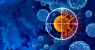 107366395-1706630752771-gettyimages-1477214805-cancer-detection.jpeg